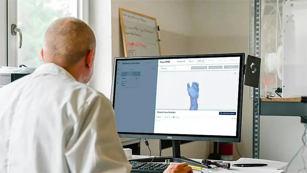 A technician reviews a 3D model of a hand on a computer for custom medical implant design and evaluation.